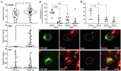 Modulation of Vagal Sensory Neurons via High Mobility Group Box-1 and Receptor for Advanced Glycation End Products: Implications for Respiratory Viral Infections